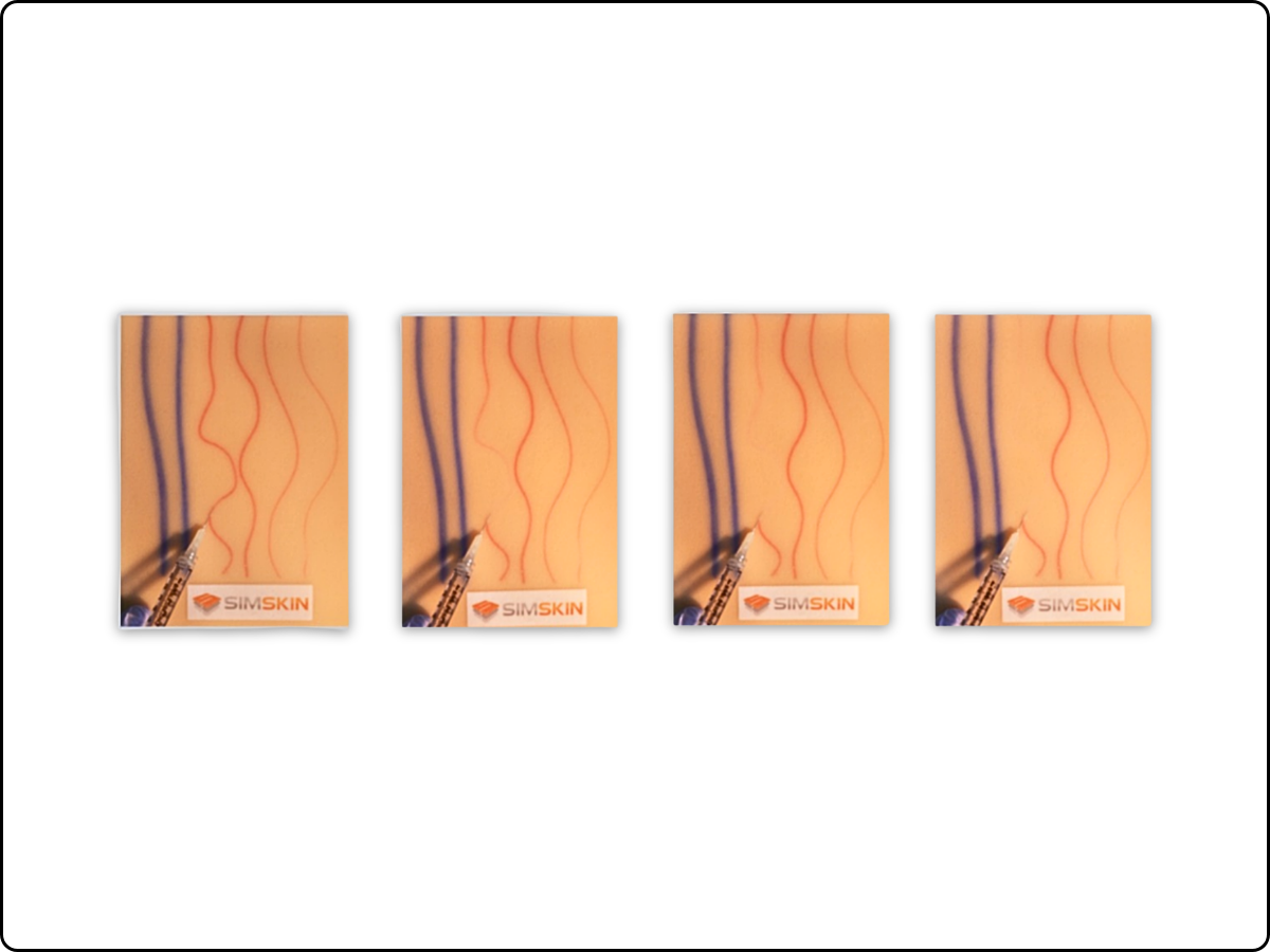 Sclerotherapy Pad image 1